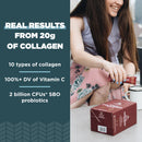 Ancient Nutrition Collagen Powder Protein with Probiotics, Multi Collagen Protein, Unflavored, 60 Servings, Hydrolyzed Collagen Peptides Supports Skin and Gut Health, Joint Supplement, 21.38oz