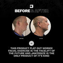 Jawzrsize Jaw Exerciser - Pop N Go Jaw Trainer, Jaw Clenching Relief, Double Chin Reducer, Jawline Shaper and Neck Exerciser