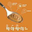 Lakanto Sugar Free Chocolate Sunflower Spread - Monk Fruit Sweetener, Keto Diet Friendly, Vegan, Dutch Cocoa, Chocolate Spread Use for Breakfast, Desserts, Snacks, and More (10 oz)